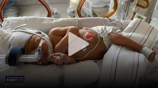 Neonatal baby, laying down in an incubator with medical devices attached all over it's small body