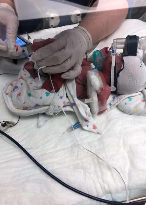 Barrett in the NICU